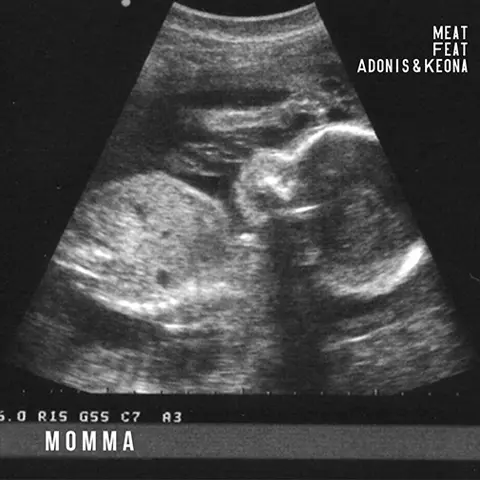 Meat "Momma" Featuring Keona & Adonis - Official Video
